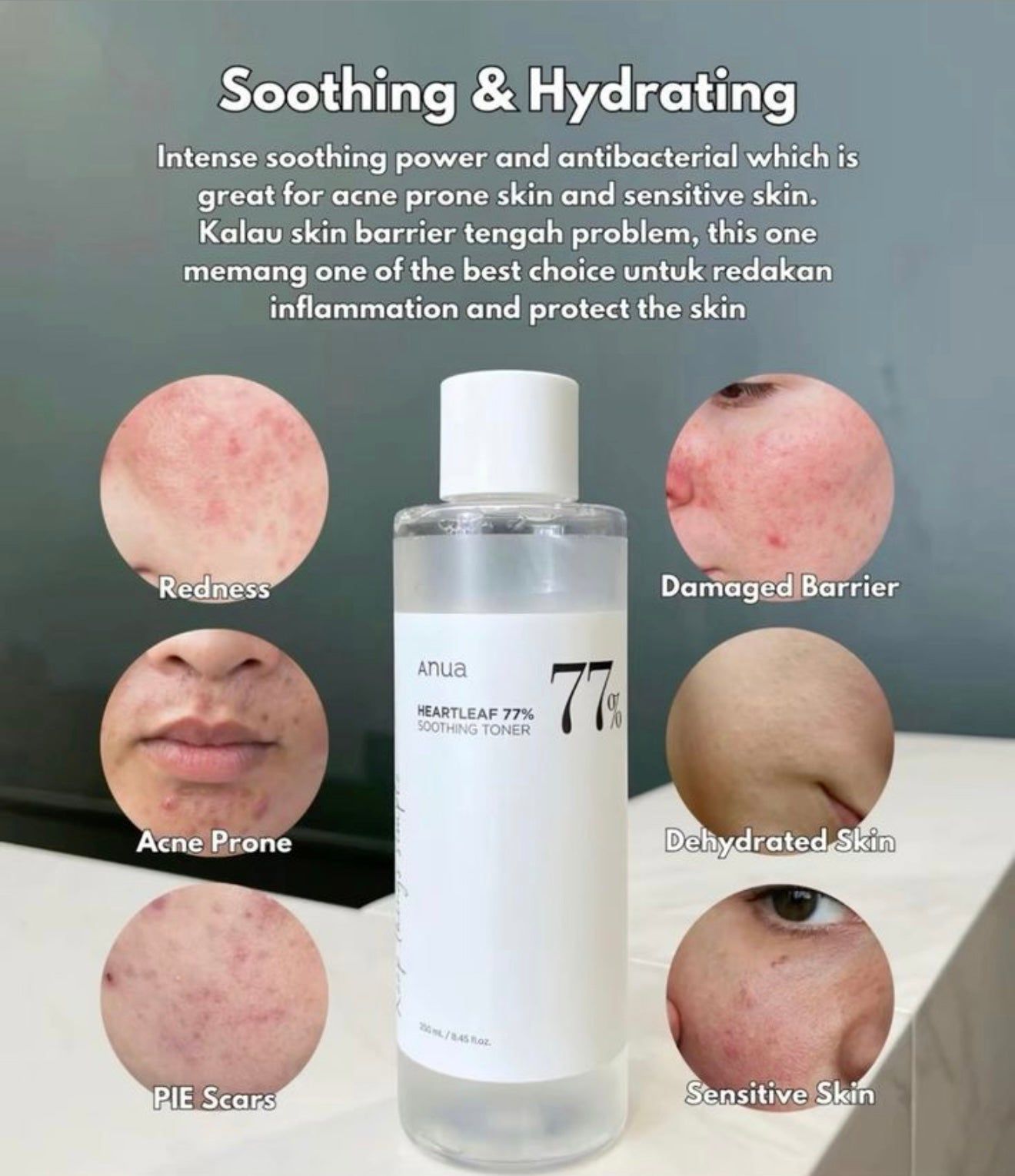 Anua Heartleaf 77% Soothing Toner Calming & Hydrating Redness Relief 40ML