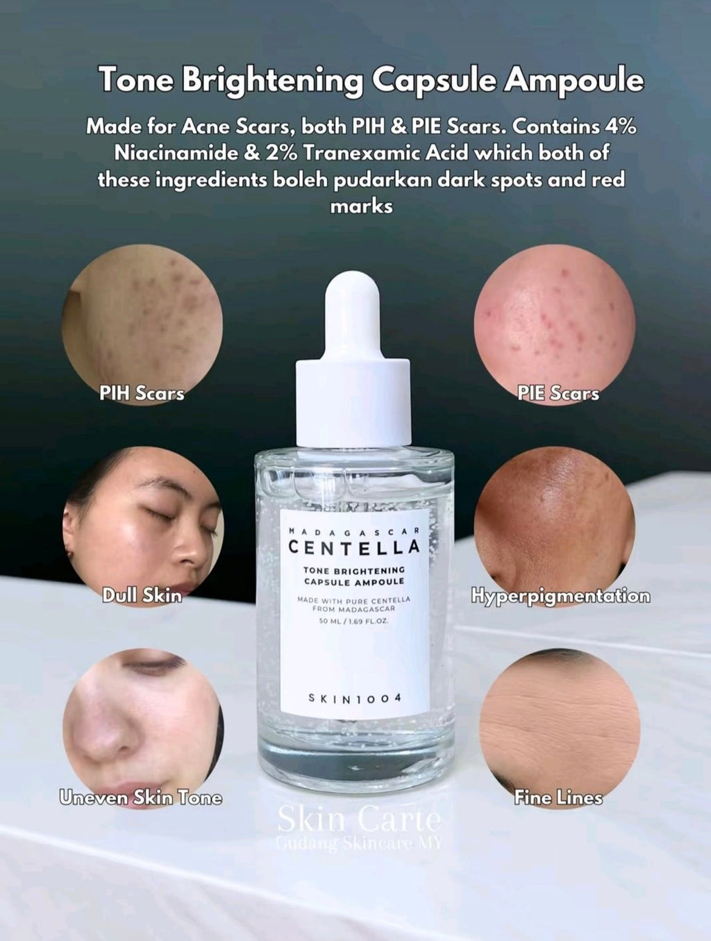 SKIN1004 Centella Ampoule Face Serum - Tone Brightening & Spot Correcting
